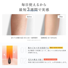 家庭用光美容器 Deparee