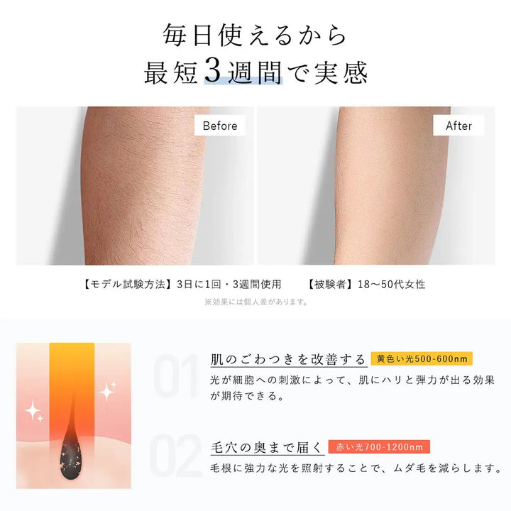 家庭用光美容器 Deparee